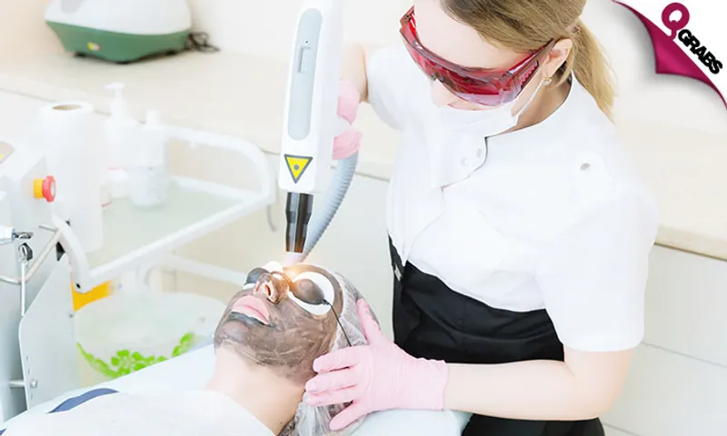 Carbon Laser Facial Treatment for Ladies & Men!